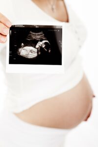 Pregnancy and ultrasound 