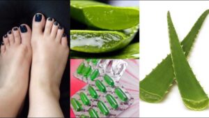 Home remedies for cracked heels 
